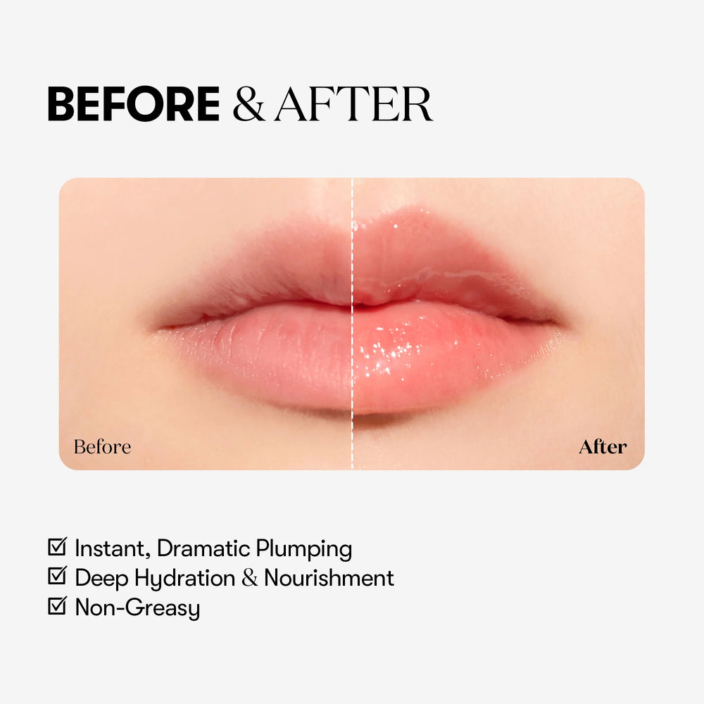 Reedle shot Lip Plumper Expert